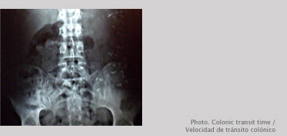 Colonic transit time
