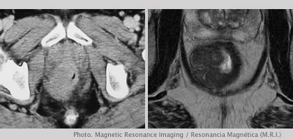 Magnetic Resonance Imaging