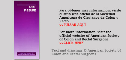 Anal Fissure