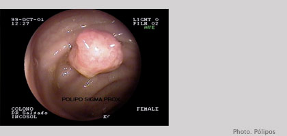 Pólipos